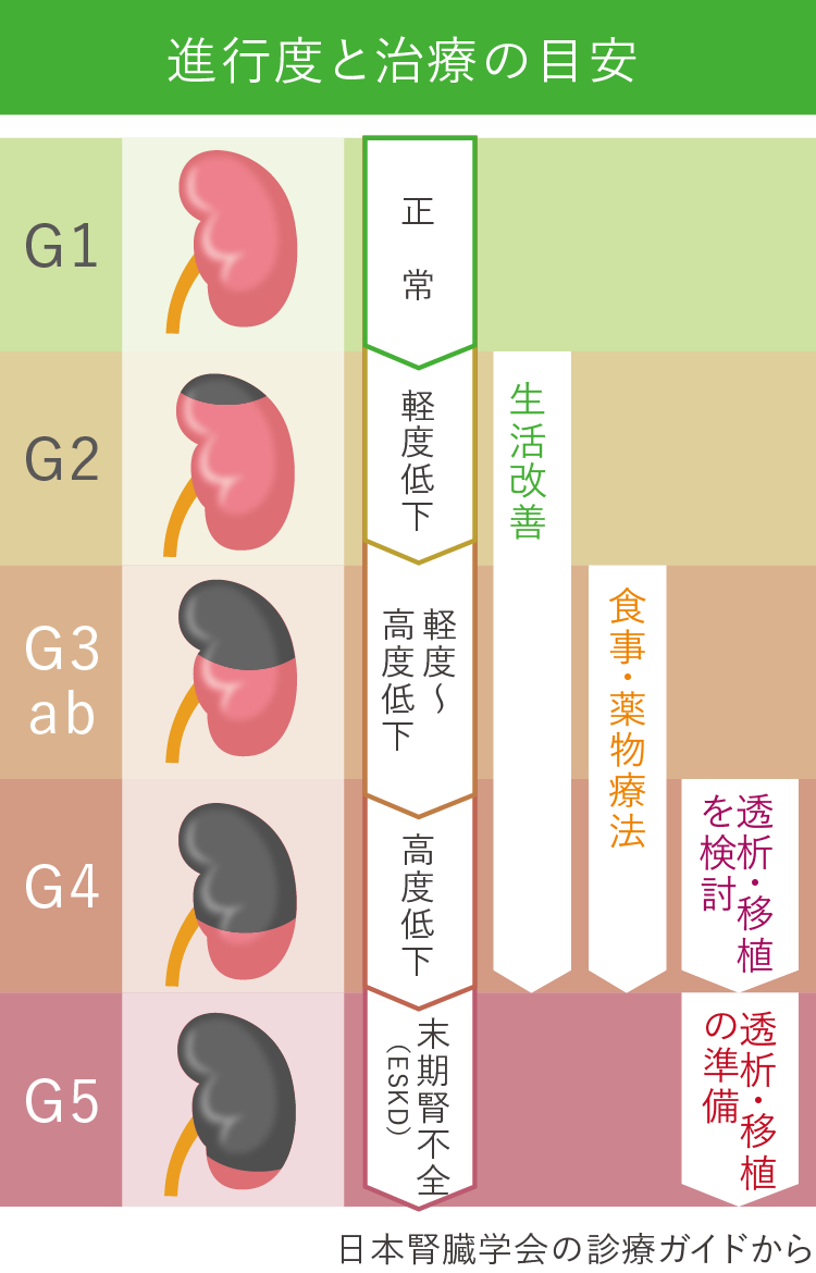 慢性腎臓病 | JR札幌病院
