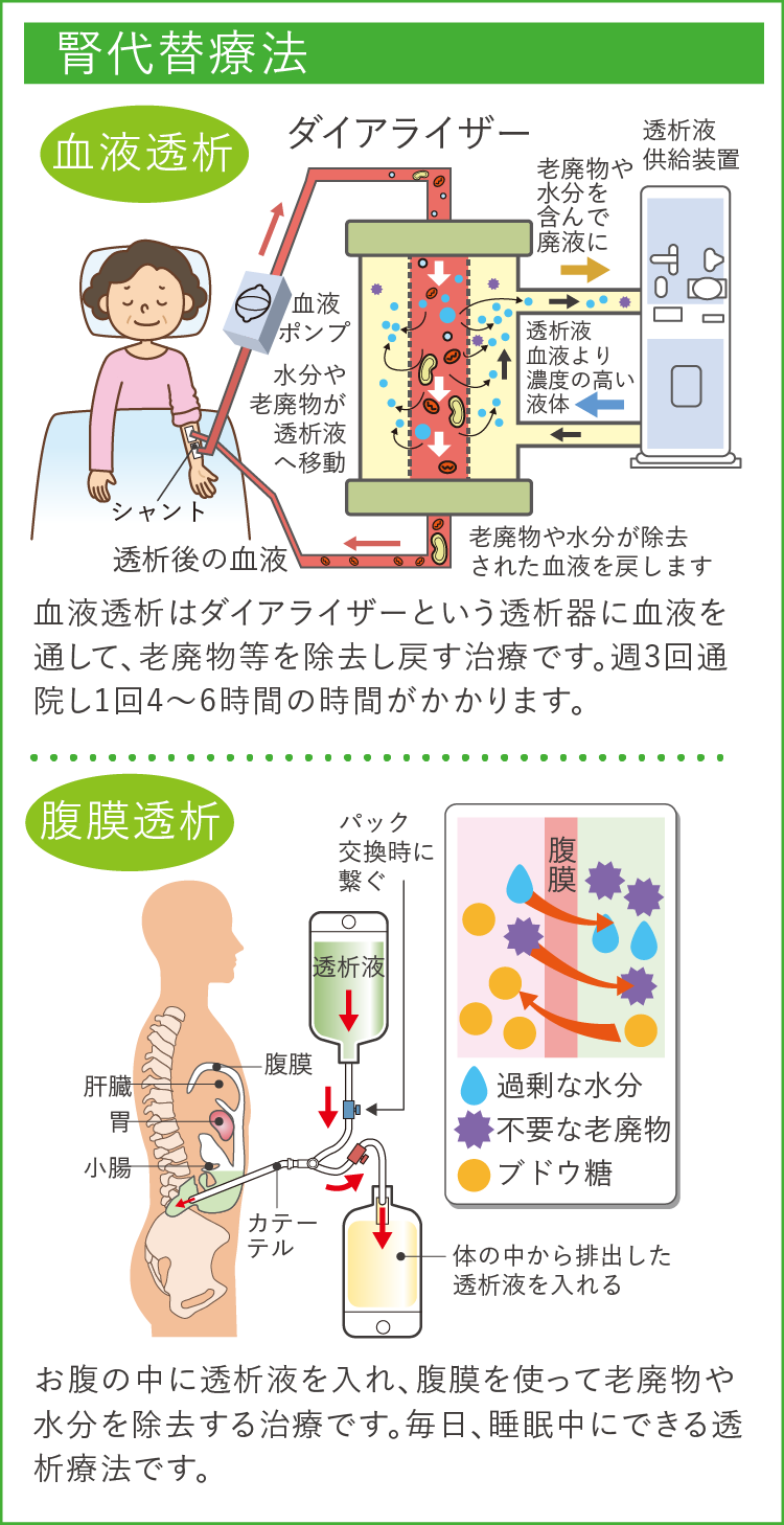 慢性腎臓病 | JR札幌病院