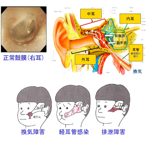 鼓室形成術 | JR札幌病院